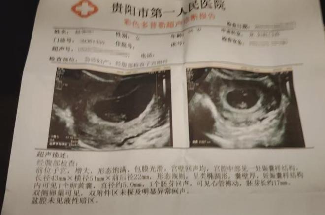 妇担忧:害怕美味成“隐患”麻将胡了2火锅底料过期孕(图3) 妇担忧:害怕美味成“隐患”麻将胡了2火锅底料过期孕(图3)